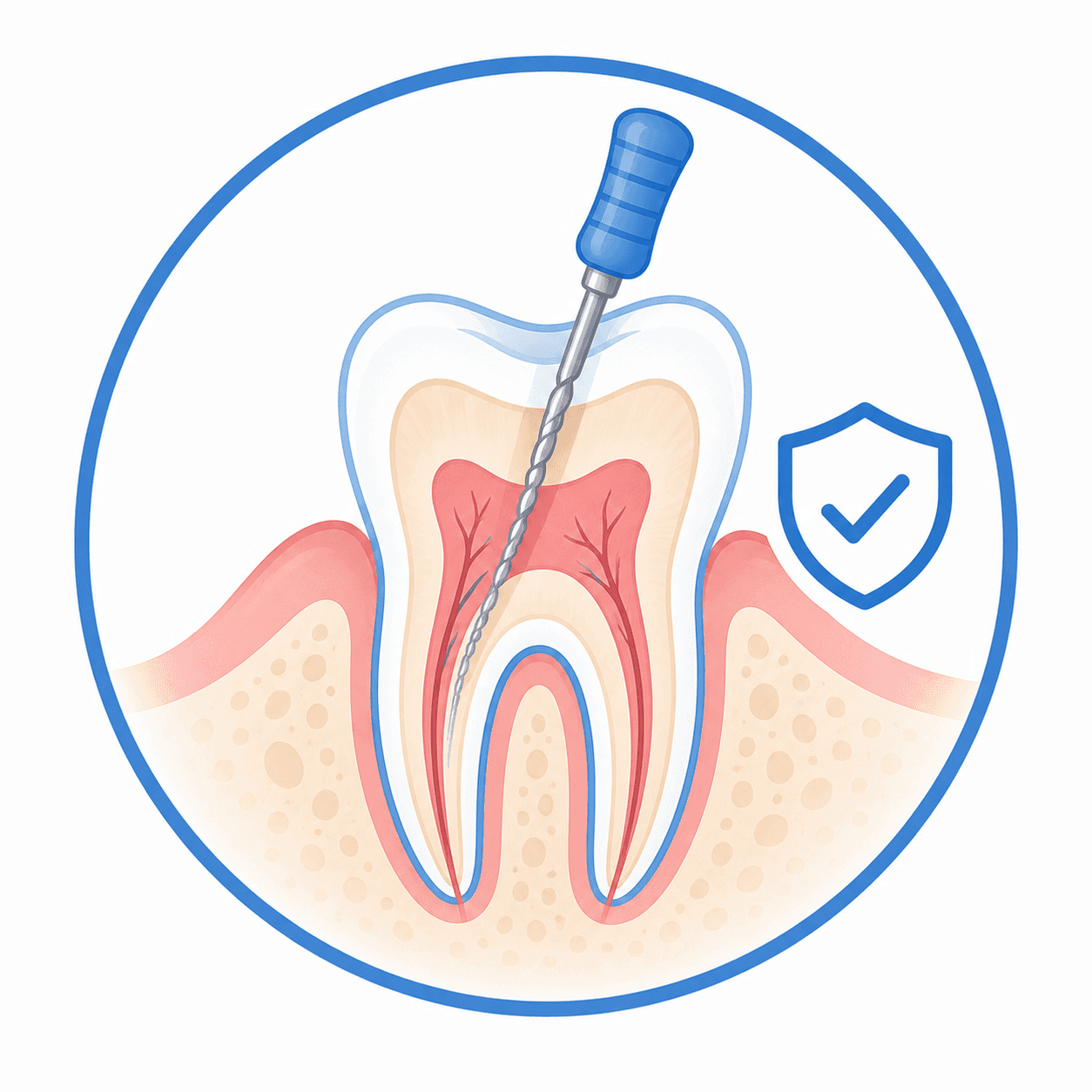 Root Canal Treatment