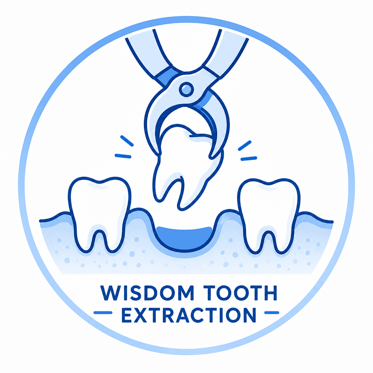Wisdom Tooth Extraction